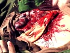 Click To Learn More About Tactical Medicine Training
