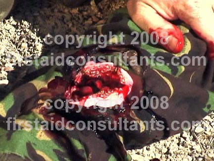 Click To Learn More About Tactical Medicine Training