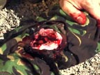 Click To Learn More About Tactical Medicine Training