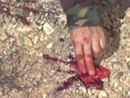 Click To Learn More About Tactical Medicine Training