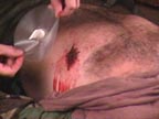 Click To Learn More About Tactical Medicine Training
